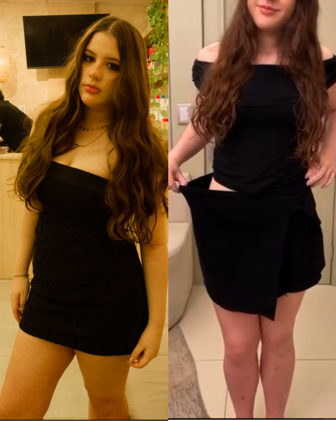 Antes e depois de uma paciente acompanhada pela Dra. Gabriela Amarante