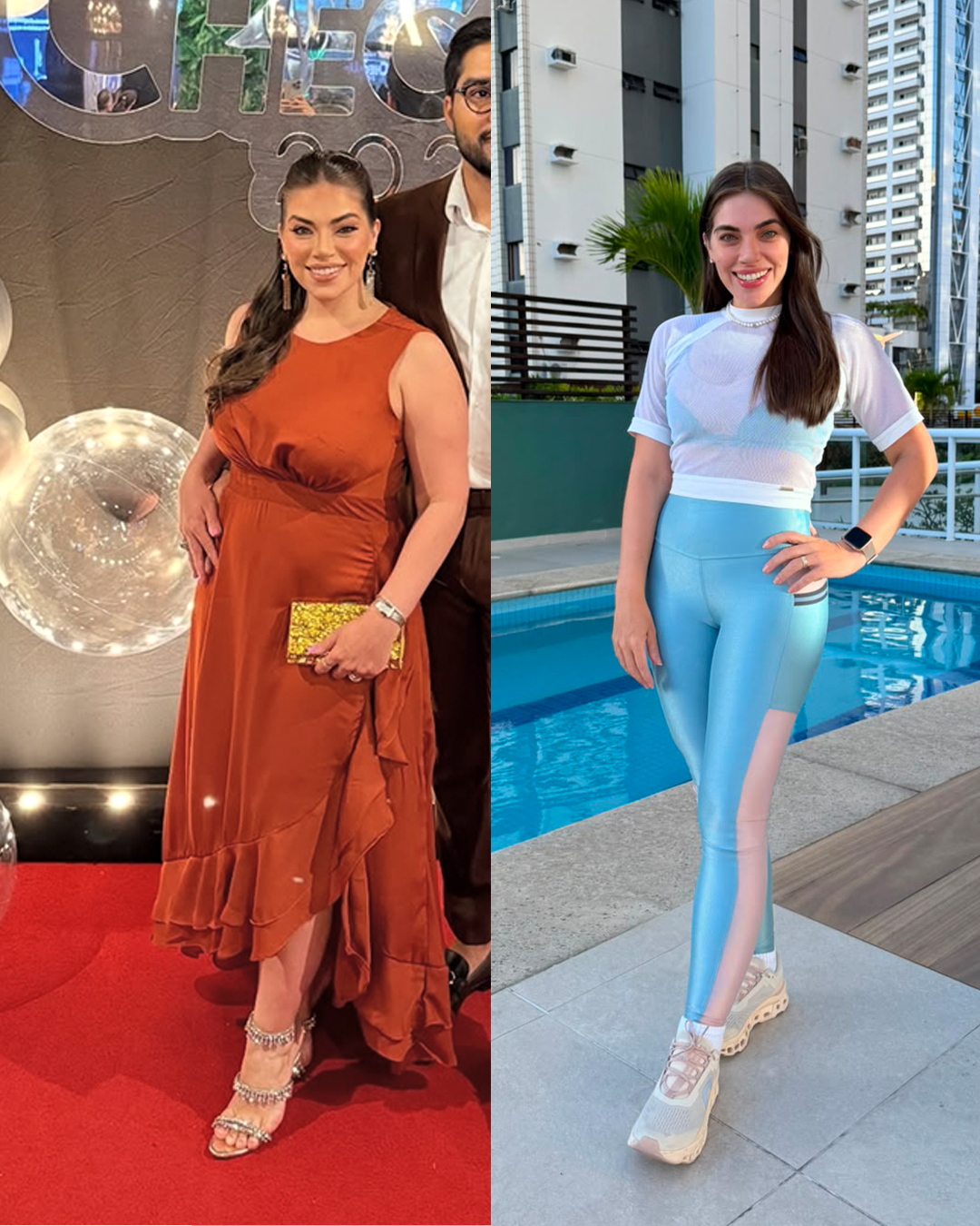 Antes e depois de outra paciente acompanhada pela Dra. Gabriela Amarante